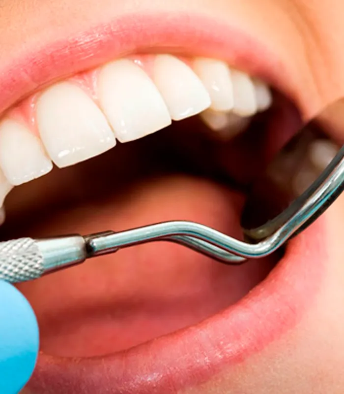 Revisión dental con espejo intraoral durante un tratamiento de odontología conservadora